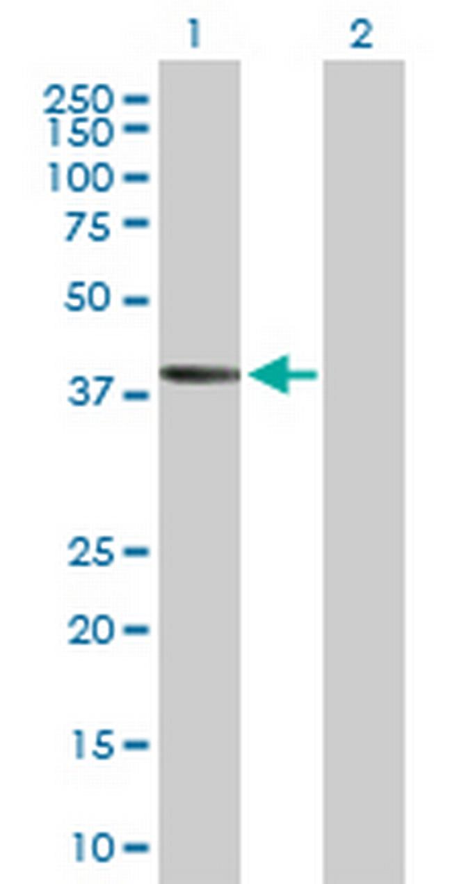 AADACL2 Antibody in Western Blot (WB)