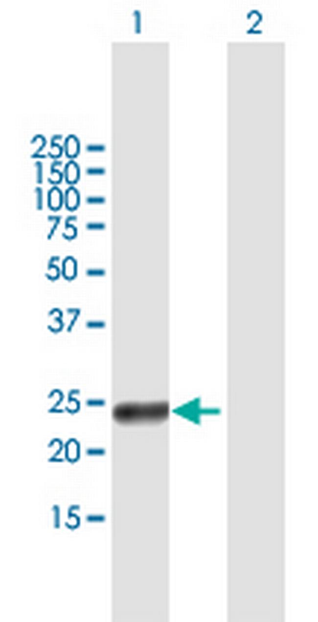 RAET1G Antibody in Western Blot (WB)