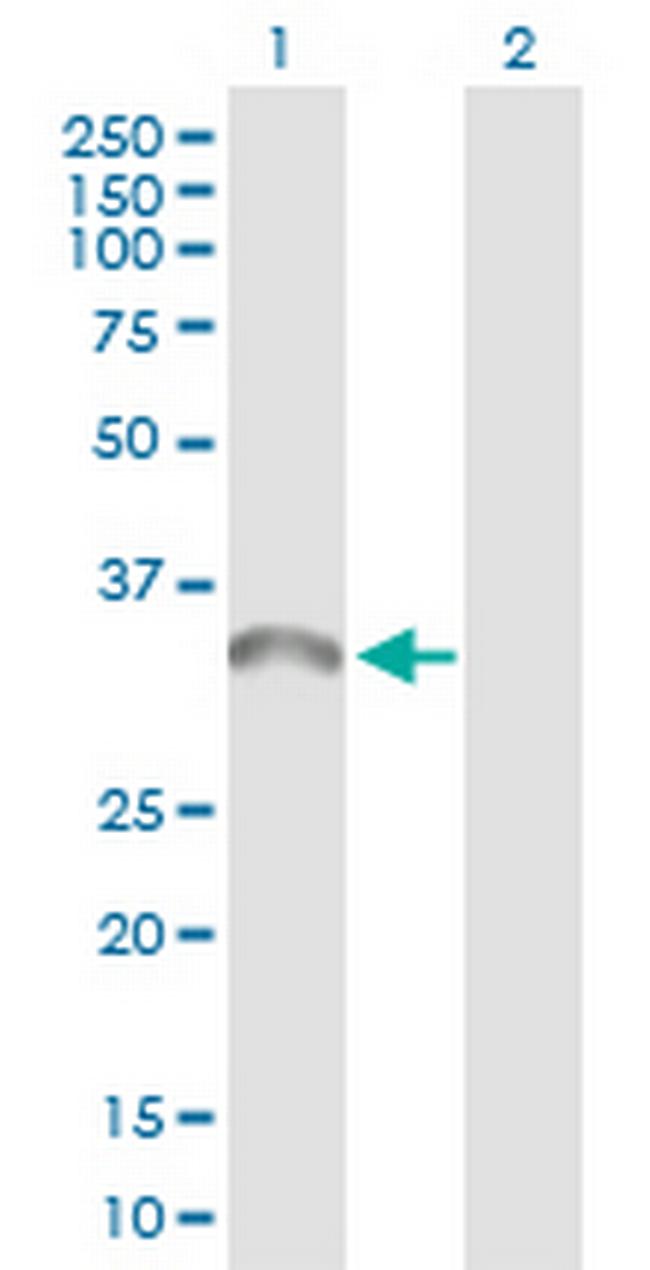 TICAM2 Antibody in Western Blot (WB)