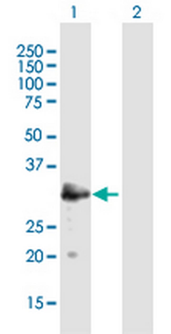 MAST4 Antibody in Western Blot (WB)