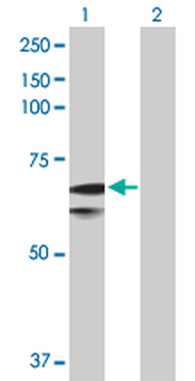 SLC27A1 Antibody in Western Blot (WB)