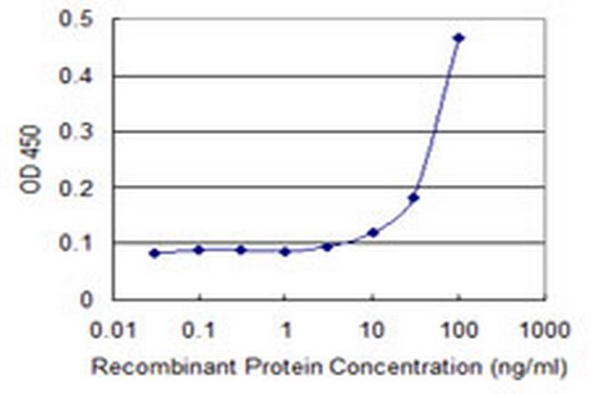 SLC27A1 Antibody in ELISA (ELISA)