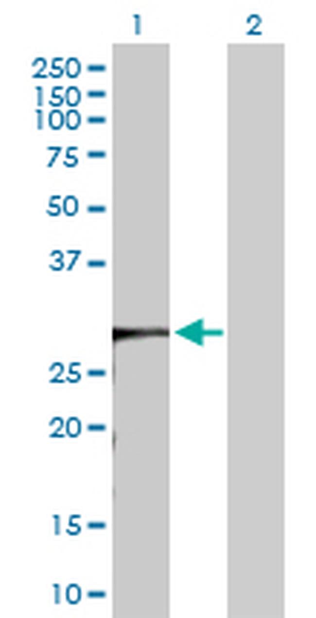 KCTD4 Antibody in Western Blot (WB)