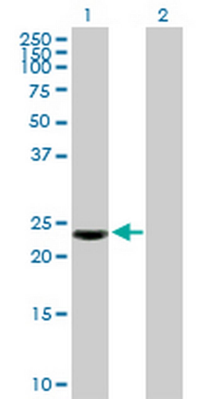 KRTAP10-2 Antibody in Western Blot (WB)