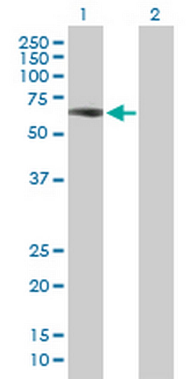 ZNF307 Antibody in Western Blot (WB)