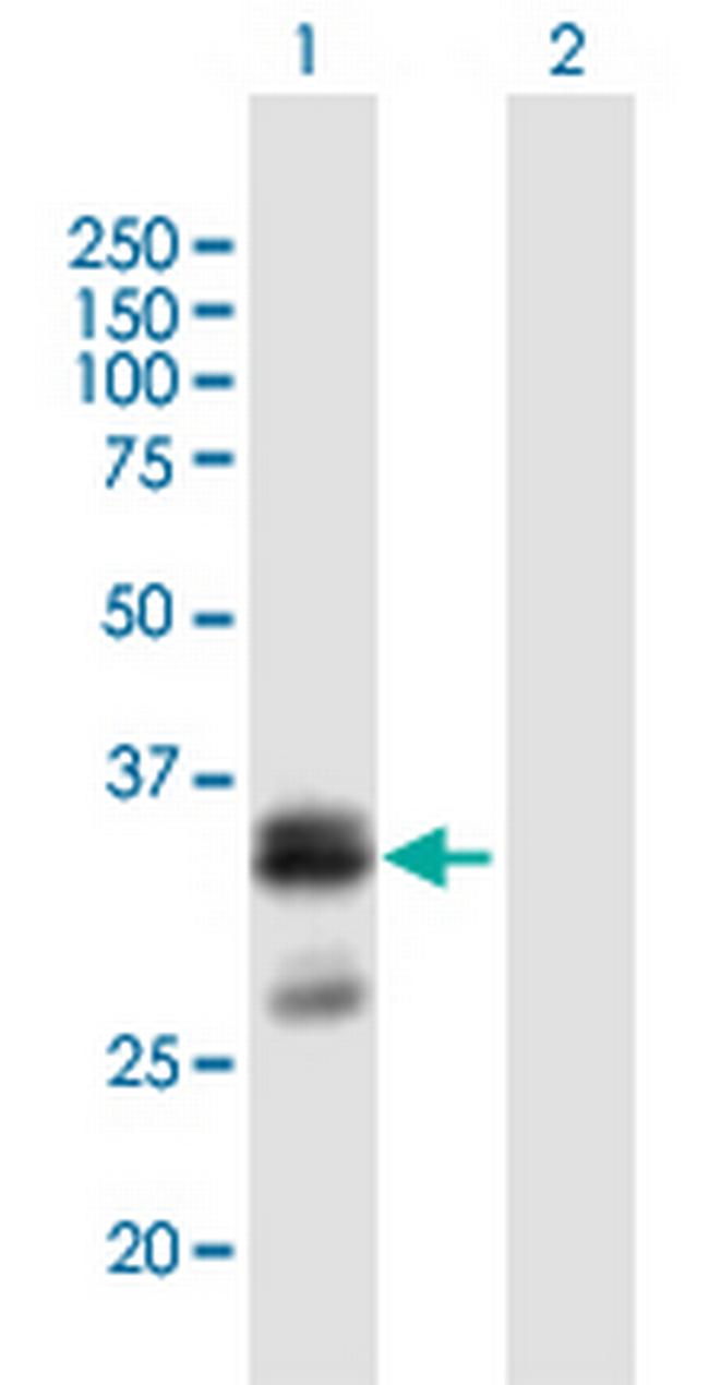 FLJ45455 Antibody in Western Blot (WB)