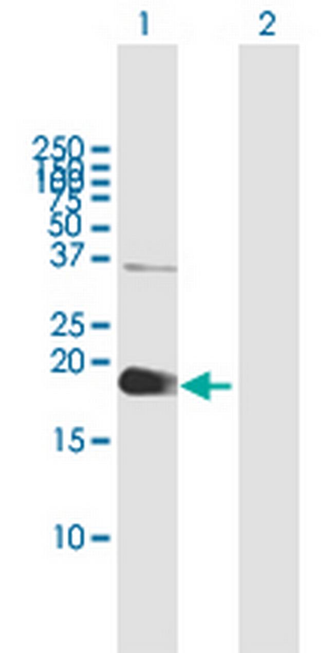 ZCCHC13 Antibody in Western Blot (WB)