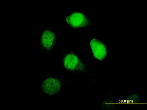 BRCC2 Antibody in Immunocytochemistry (ICC/IF)