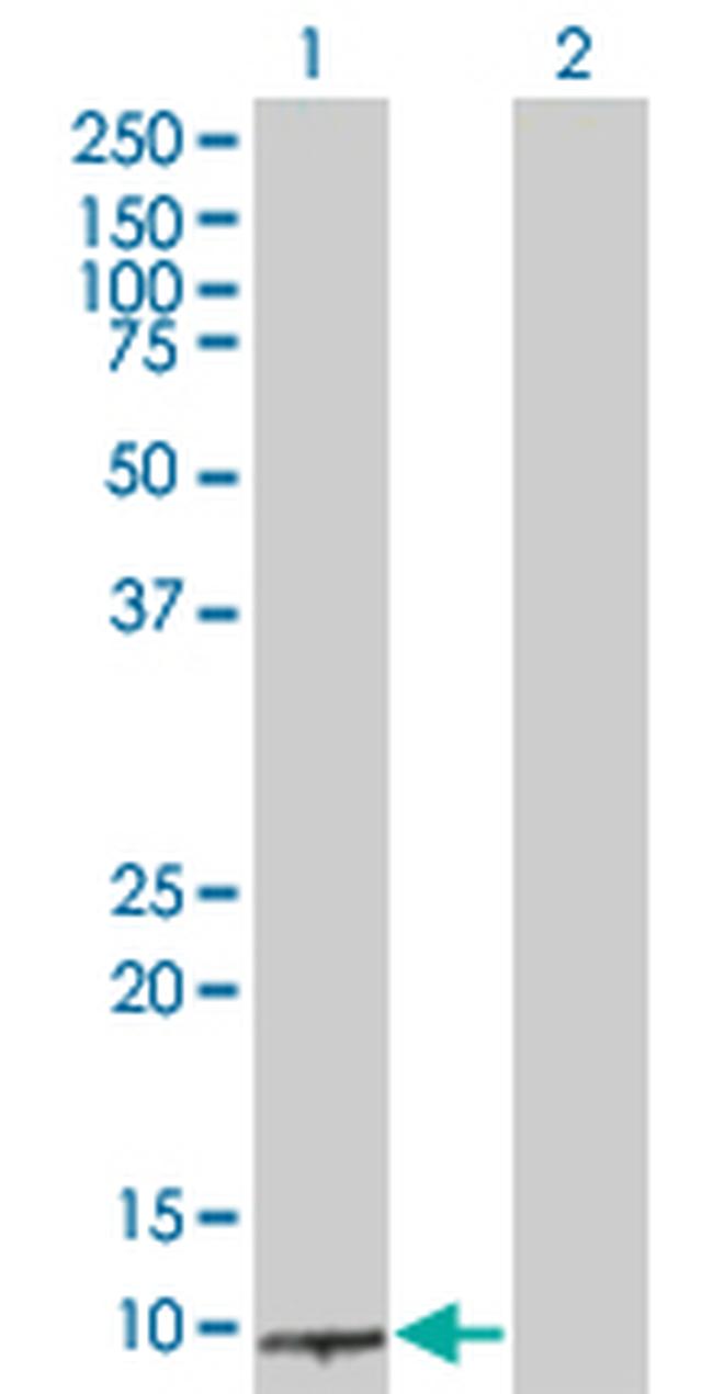 BRCC2 Antibody in Western Blot (WB)