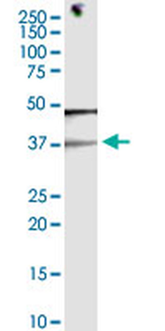 EID3 Antibody in Western Blot (WB)