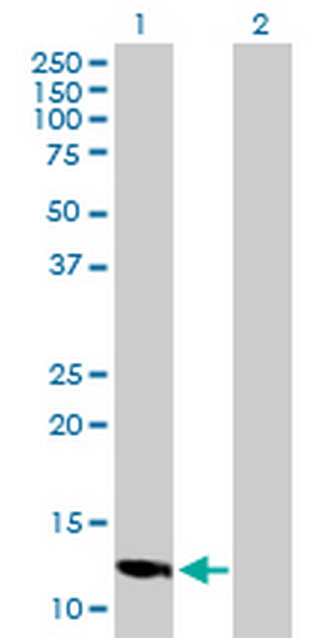 LOC494141 Antibody in Western Blot (WB)