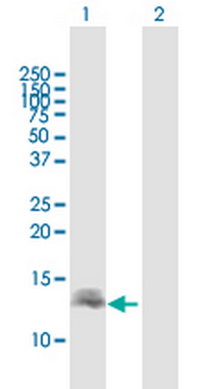 DEFB137 Antibody in Western Blot (WB)