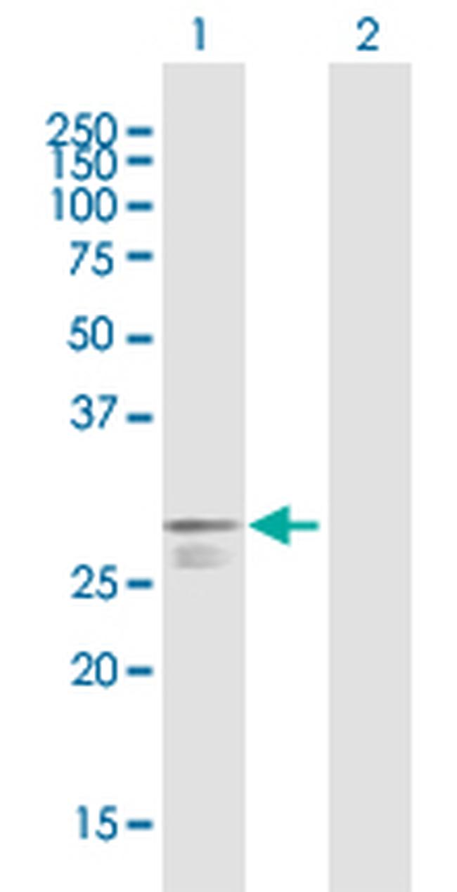 PABPCP2 Antibody in Western Blot (WB)