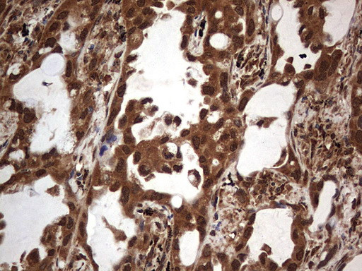 H2AFY2 Antibody in Immunohistochemistry (Paraffin) (IHC (P))