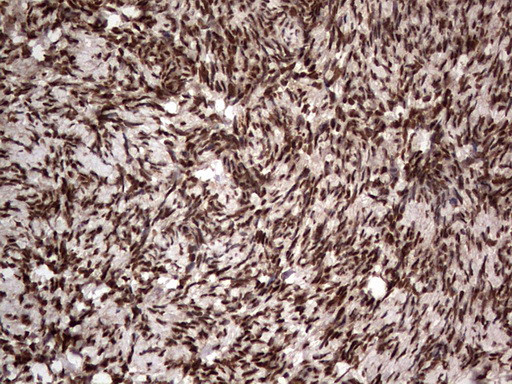 H2AFY2 Antibody in Immunohistochemistry (Paraffin) (IHC (P))