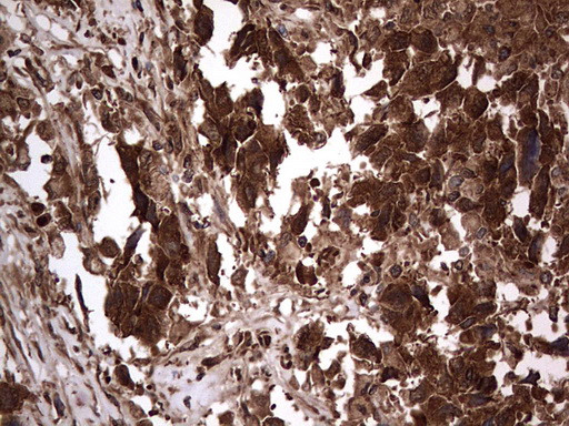 H2AFY2 Antibody in Immunohistochemistry (Paraffin) (IHC (P))