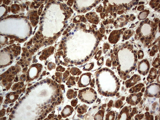 H2AFY2 Antibody in Immunohistochemistry (Paraffin) (IHC (P))