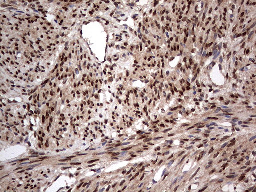 H2AFY2 Antibody in Immunohistochemistry (Paraffin) (IHC (P))