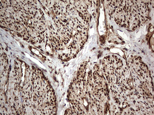 H2AFY2 Antibody in Immunohistochemistry (Paraffin) (IHC (P))