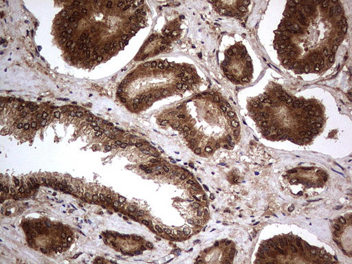 H2AFY2 Antibody in Immunohistochemistry (Paraffin) (IHC (P))