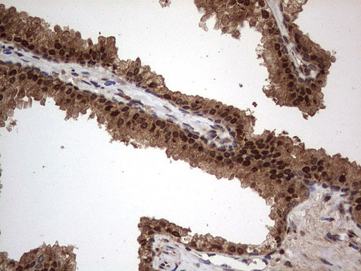 H2AFY2 Antibody in Immunohistochemistry (Paraffin) (IHC (P))