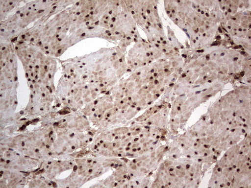 H2AFY2 Antibody in Immunohistochemistry (Paraffin) (IHC (P))