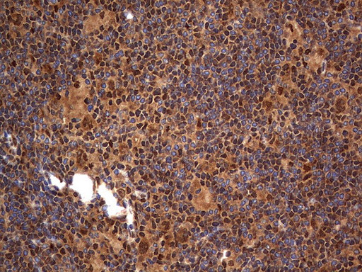 H2AFY2 Antibody in Immunohistochemistry (Paraffin) (IHC (P))