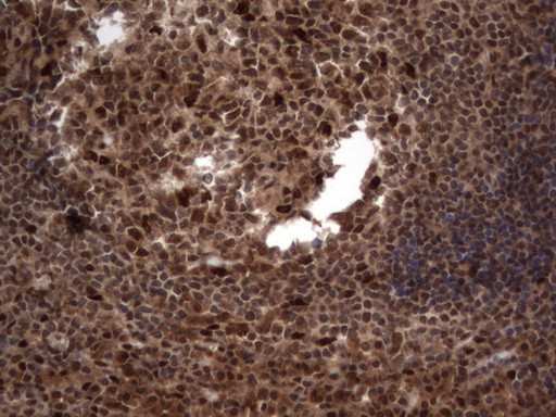 H2AFY2 Antibody in Immunohistochemistry (Paraffin) (IHC (P))