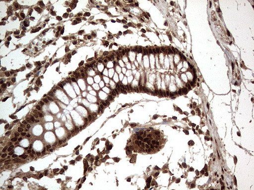 H2AFY2 Antibody in Immunohistochemistry (Paraffin) (IHC (P))