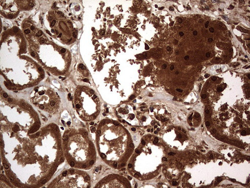 H2AFY2 Antibody in Immunohistochemistry (Paraffin) (IHC (P))