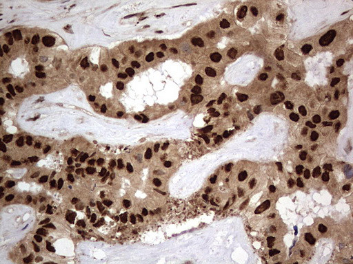 H2AFY2 Antibody in Immunohistochemistry (Paraffin) (IHC (P))