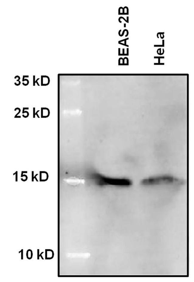 H2BK5ac Antibody in Western Blot (WB)