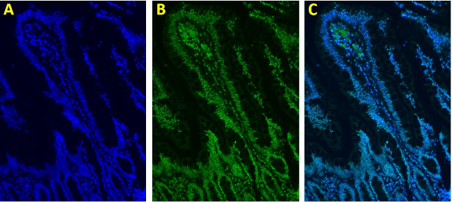 Rabbit IgG (H+L) Highly Cross-Adsorbed Secondary Antibody in Immunocytochemistry (ICC/IF)