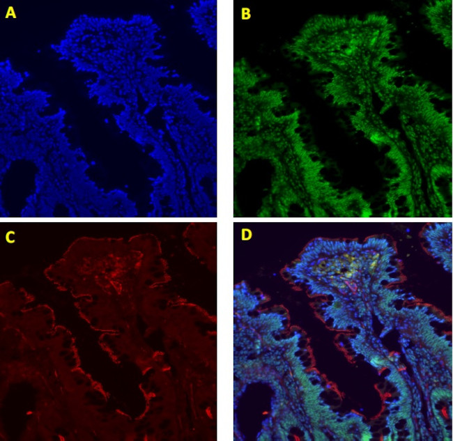 Rabbit IgG (H+L) Highly Cross-Adsorbed Secondary Antibody in Immunocytochemistry (ICC/IF)