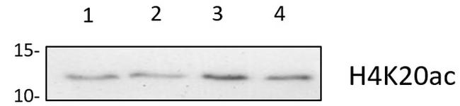 H4K20ac Antibody in Western Blot (WB)