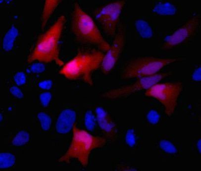 HA Tag Antibody in Immunocytochemistry (ICC/IF)