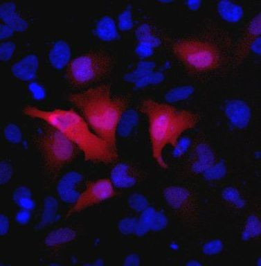 HA Tag Antibody in Immunocytochemistry (ICC/IF)