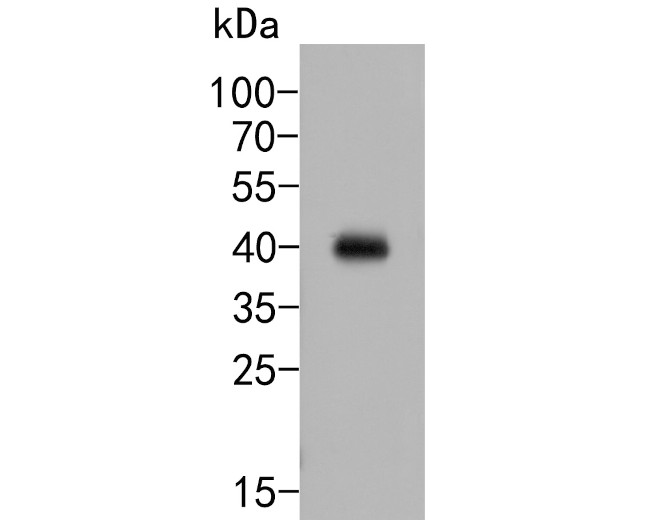 FCGRT Antibody in Western Blot (WB)