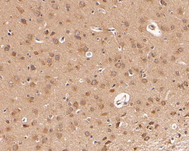 Dopamine Transporter Antibody in Immunohistochemistry (Paraffin) (IHC (P))