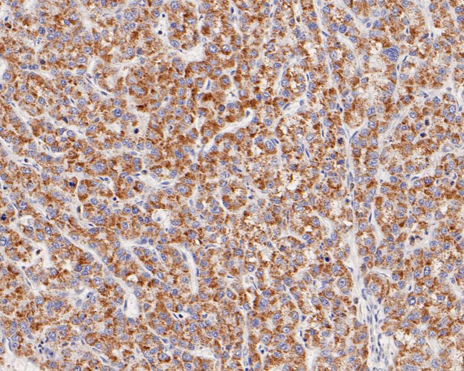 ME2 Antibody in Immunohistochemistry (Paraffin) (IHC (P))