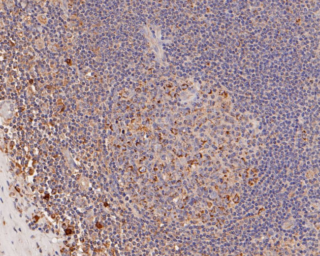 ME2 Antibody in Immunohistochemistry (Paraffin) (IHC (P))