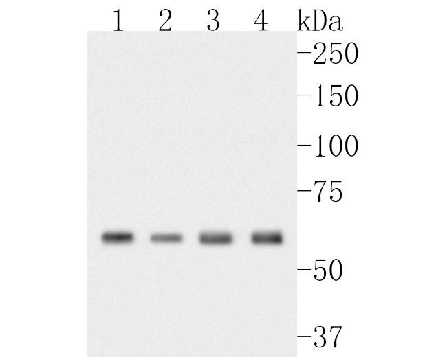 ME2 Antibody in Western Blot (WB)