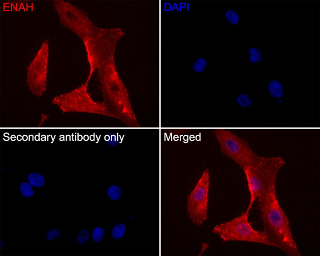 ENAH Antibody in Immunocytochemistry (ICC/IF)