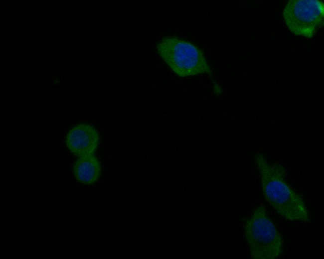 Complement factor B Antibody in Immunocytochemistry (ICC/IF)