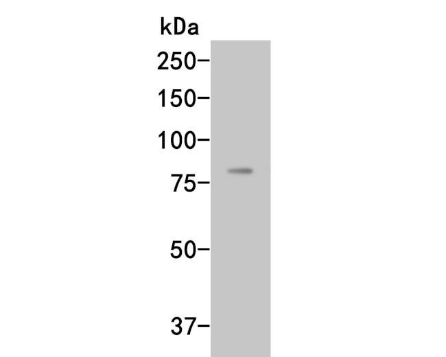 Complement factor B Antibody in Western Blot (WB)