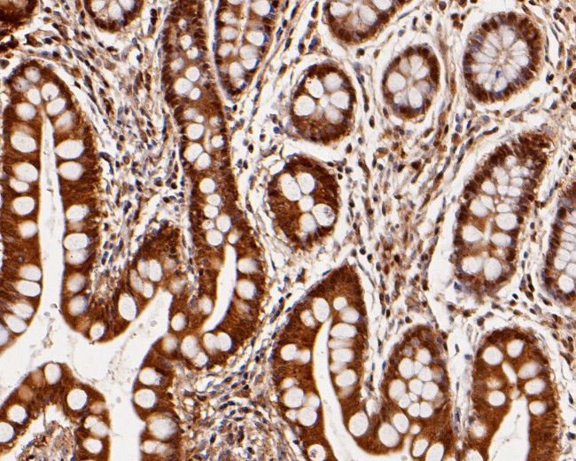 Nucleoside Phosphorylase Antibody in Immunohistochemistry (Paraffin) (IHC (P))