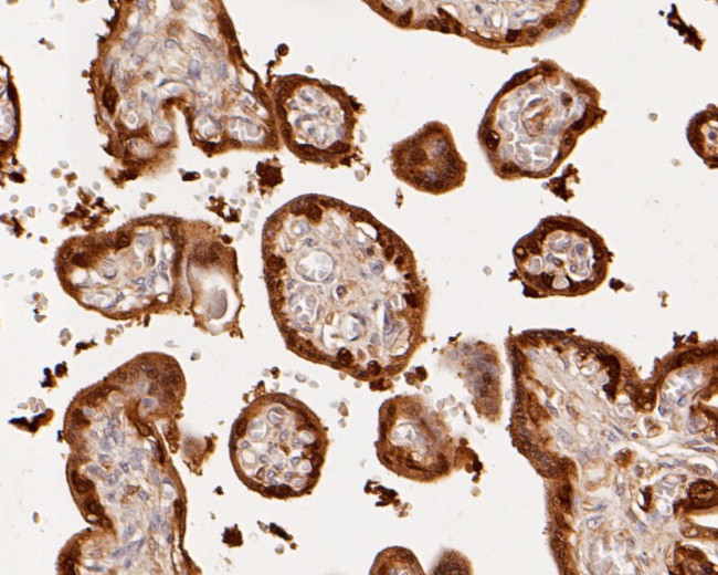 Nucleoside Phosphorylase Antibody in Immunohistochemistry (Paraffin) (IHC (P))