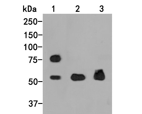 FOXG1 Antibody in Western Blot (WB)