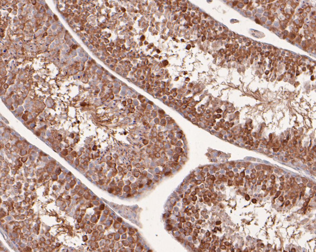 VGluT1 Antibody in Immunohistochemistry (Paraffin) (IHC (P))