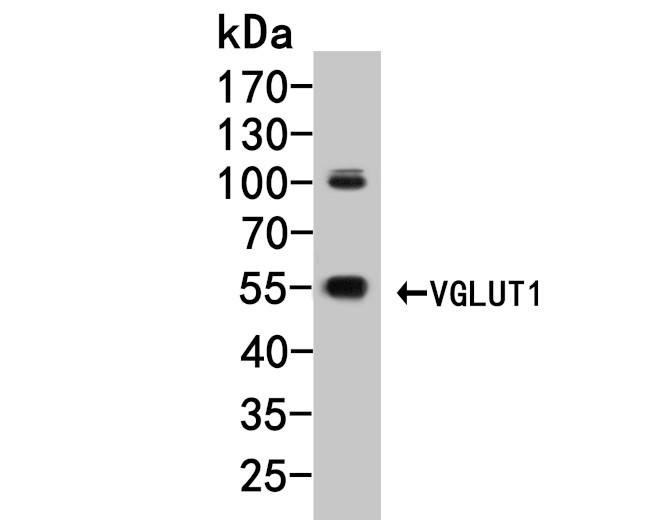 VGluT1 Antibody in Western Blot (WB)